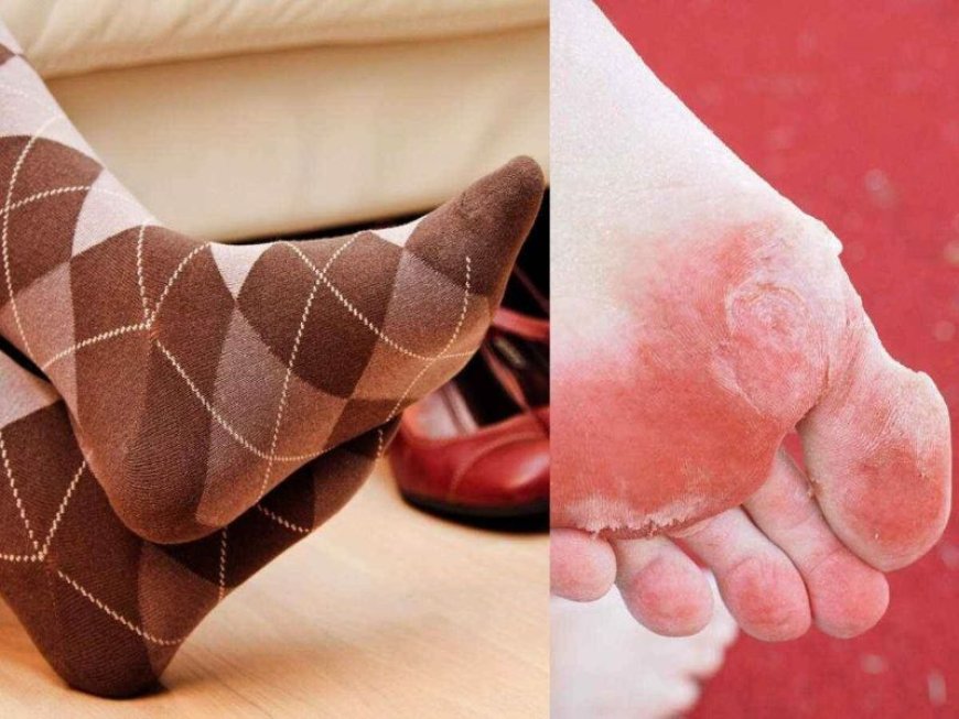 Socks Side Effects: रात में मोजे पहनने वाले हो जाए सावधान, इन गंभीर बिमारियों के हो सकते है शिकार