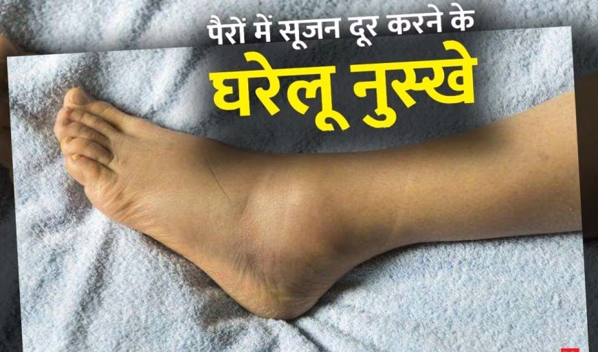 इन घरेलू उपाय से तुरंत गायब हो जाएगा पैरों का सूजन, बेहद आसान है तरीका