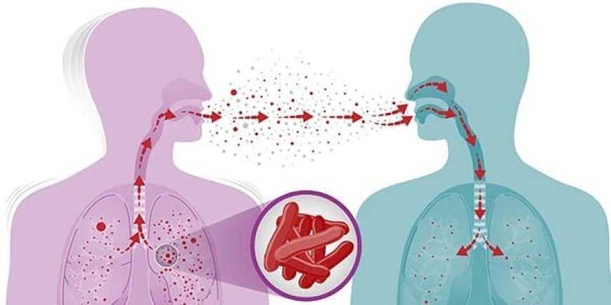 Global TB Report 2023: WHO ने जारी की ग्लोबल टीबी रिपोर्ट, भारत को लेकर बताई ये खास बात